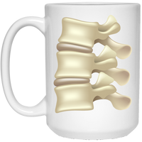 Lateral Spine: Plain