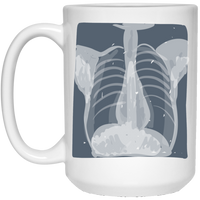 CXR: Plain