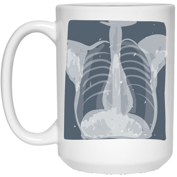 CXR: Plain